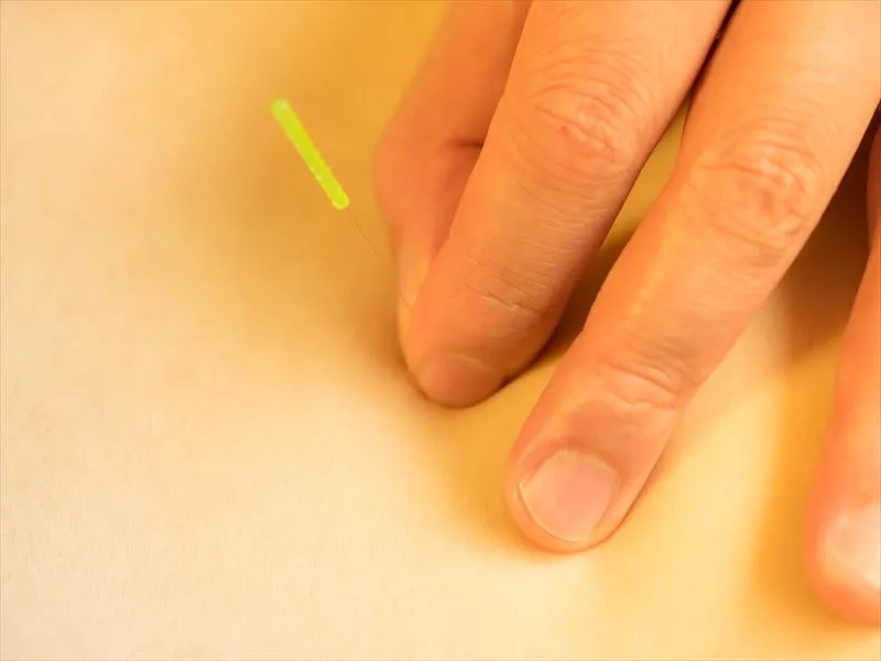 鍼の効果とは？