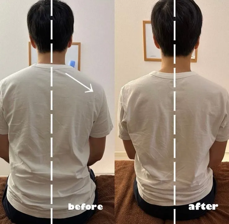 姿勢改善したい方は当院がおすすめ！