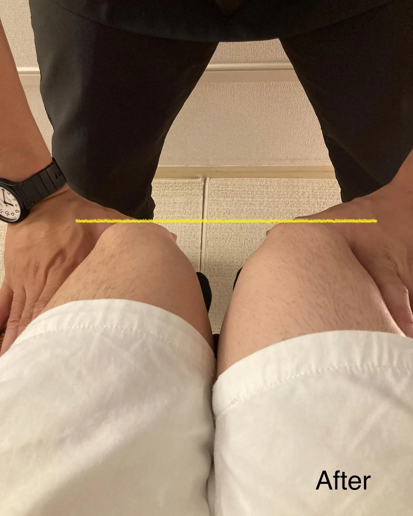 姿勢改善、骨盤調整なら当院へ！