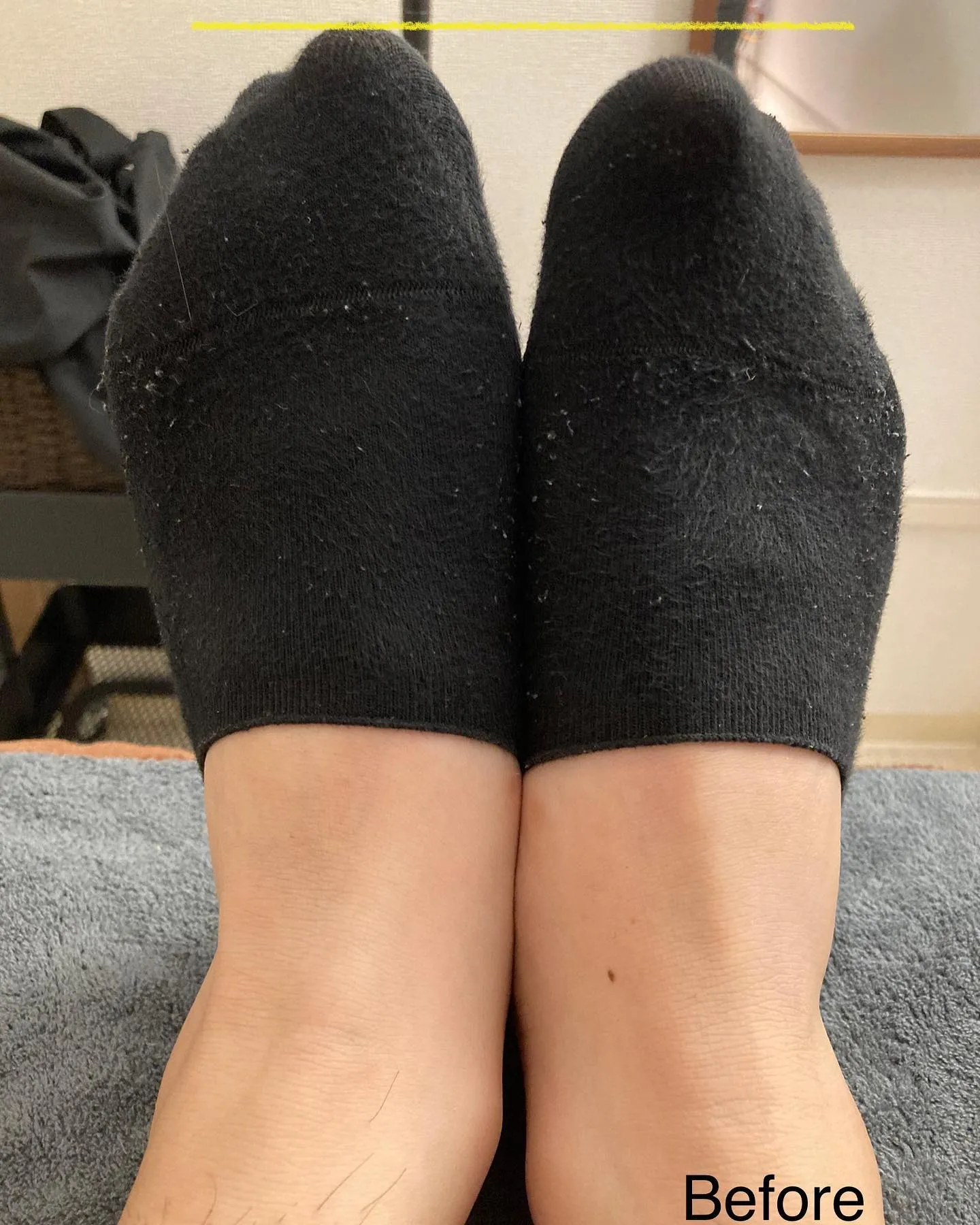 姿勢改善、骨盤調整なら当院へ！