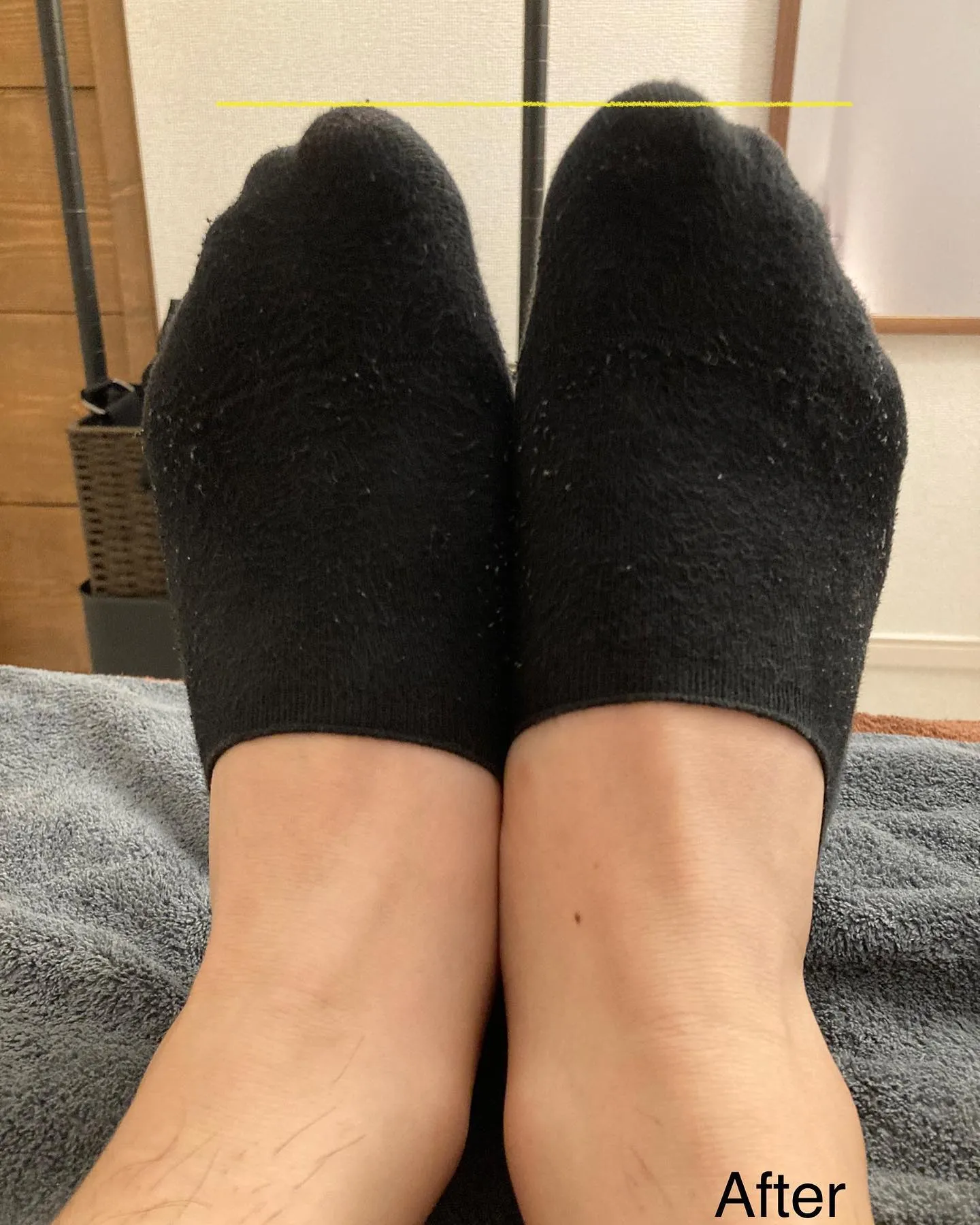 姿勢改善、骨盤調整なら当院へ！