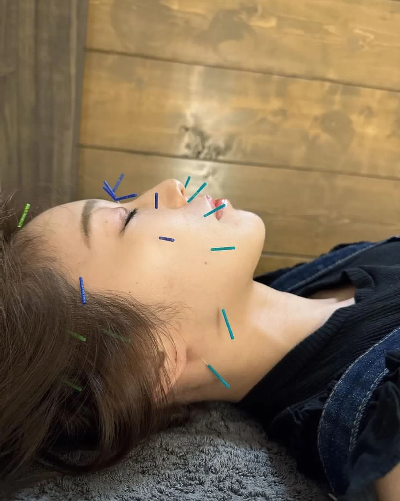 鍼灸施術なら当院へ！