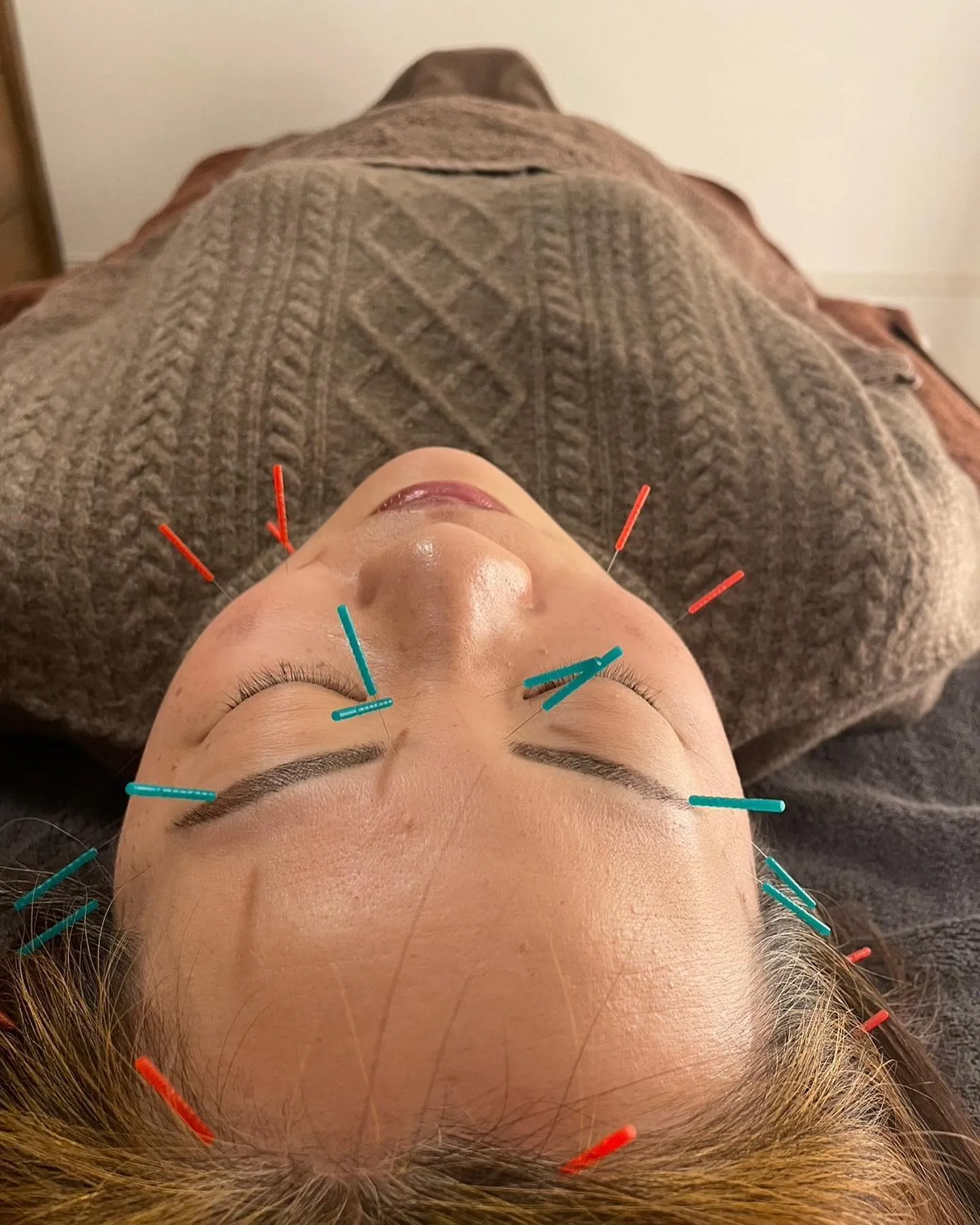 鍼灸施術なら当院へ！