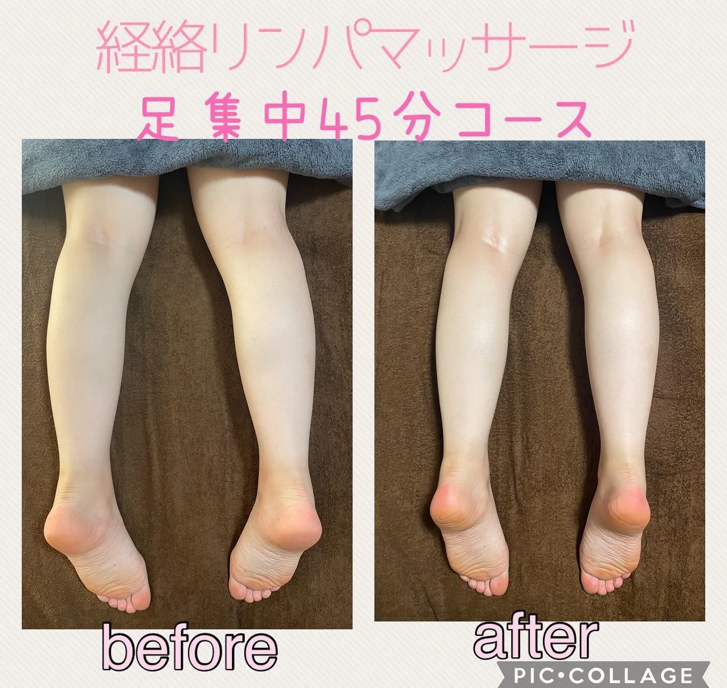 茨木市で整体なら当院へお任せ！！