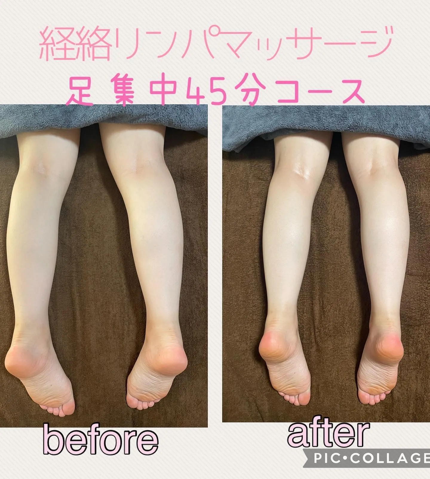 リンパマッサージなら当院の美容専科へ！