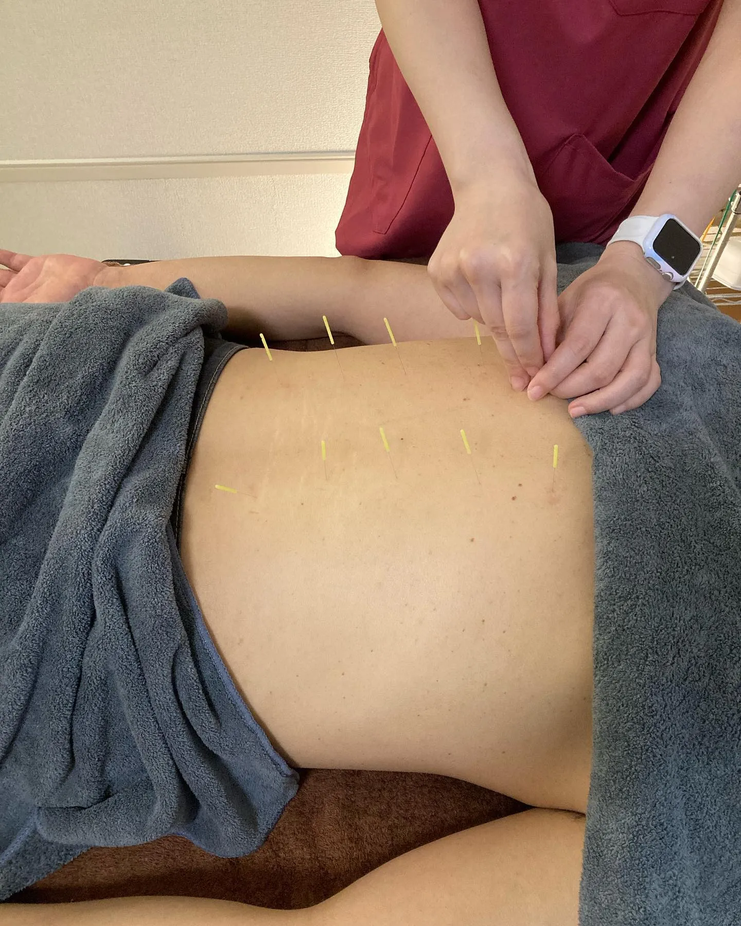 腰痛改善したいなら茨木市の当院へ！