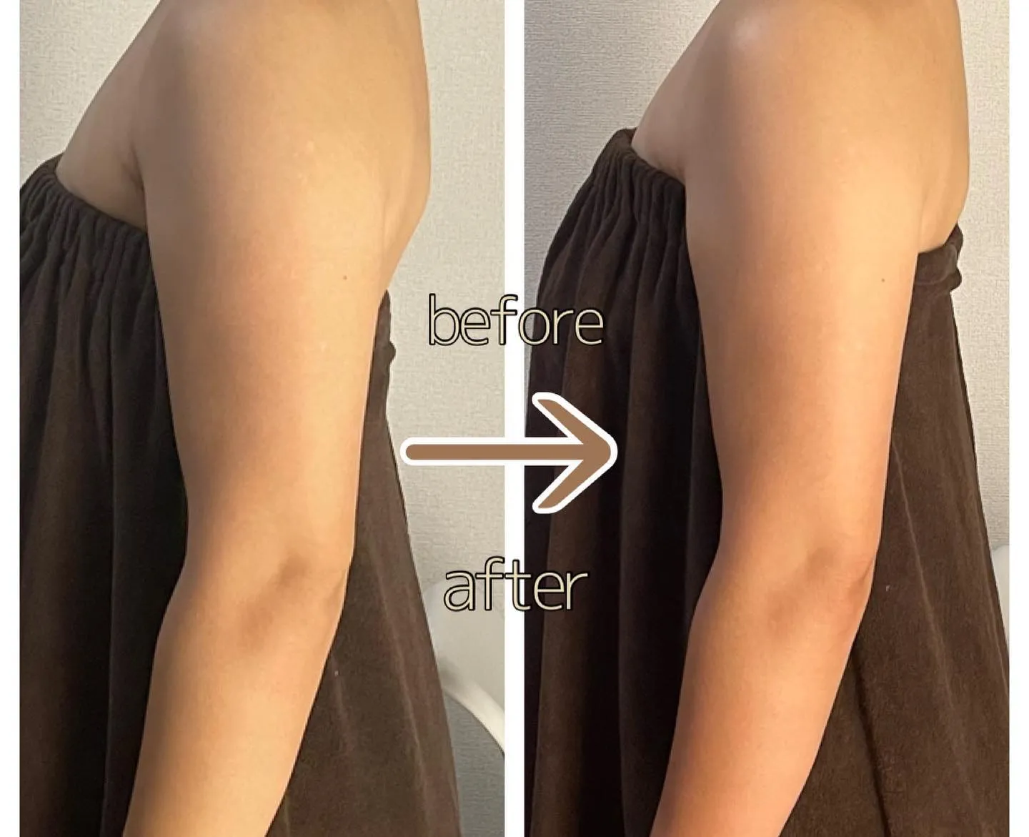 体重が減っても二の腕ってなかなか痩せてくれませんよね😂