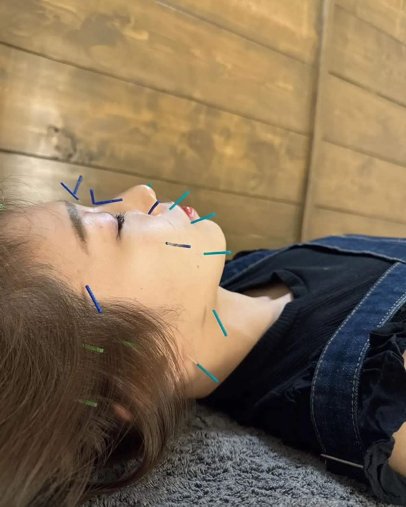 美容に興味がある方は当院へ！