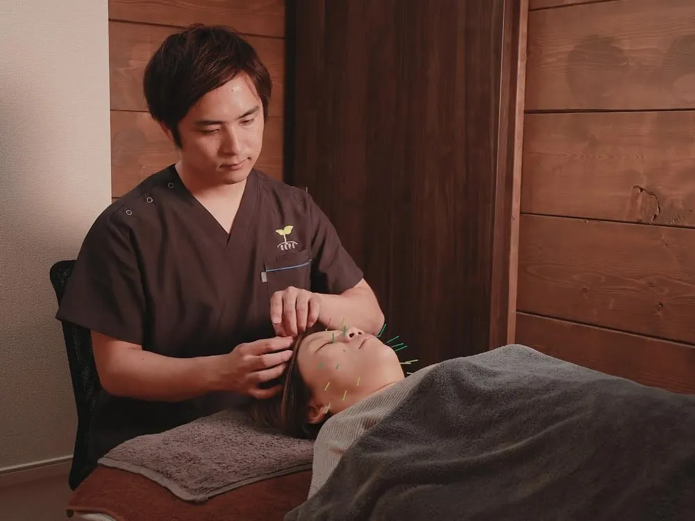 美容鍼なら当院へ！