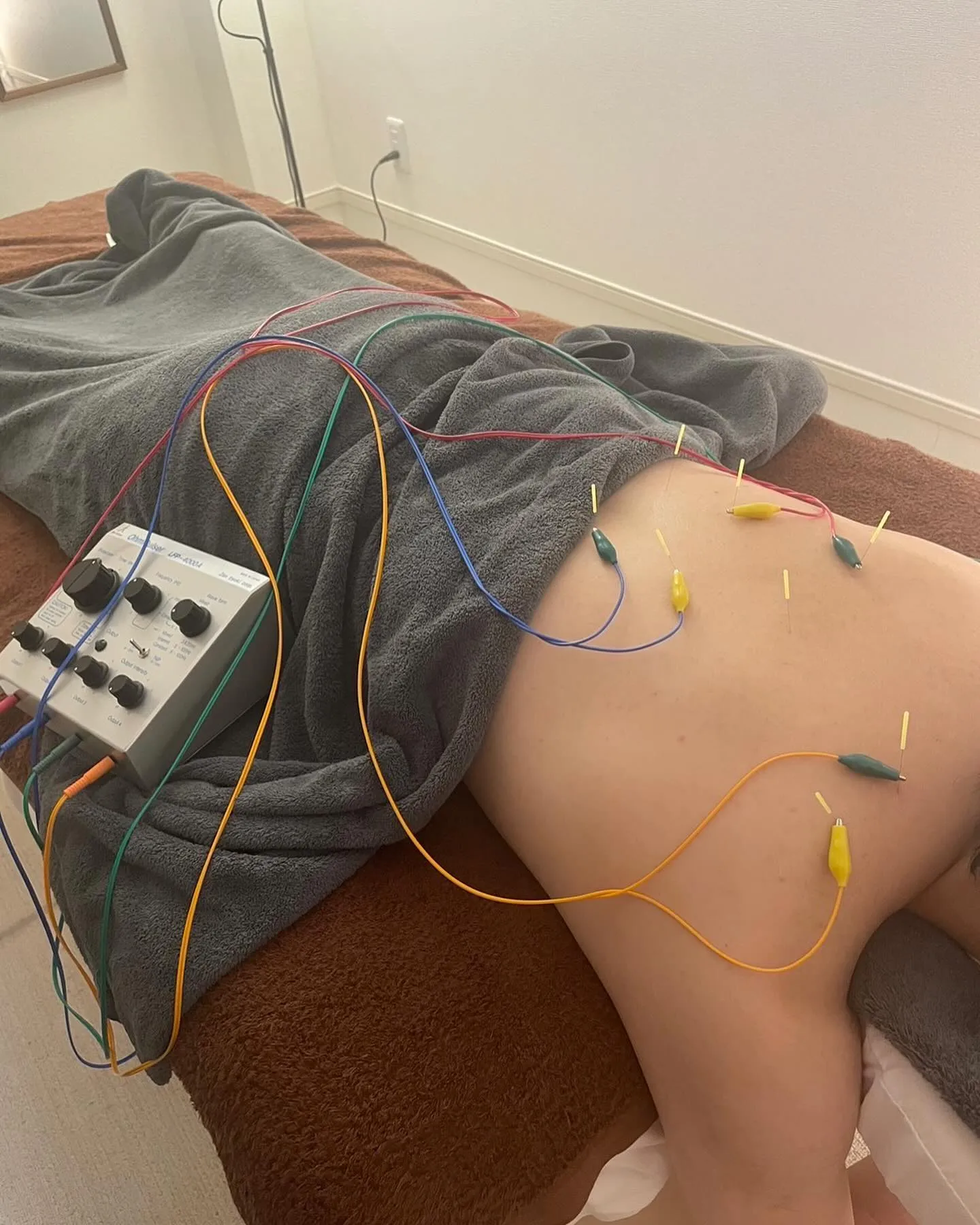 電気鍼してみませんか？